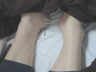 嚥下・構語障害：下肢の鍼灸治療